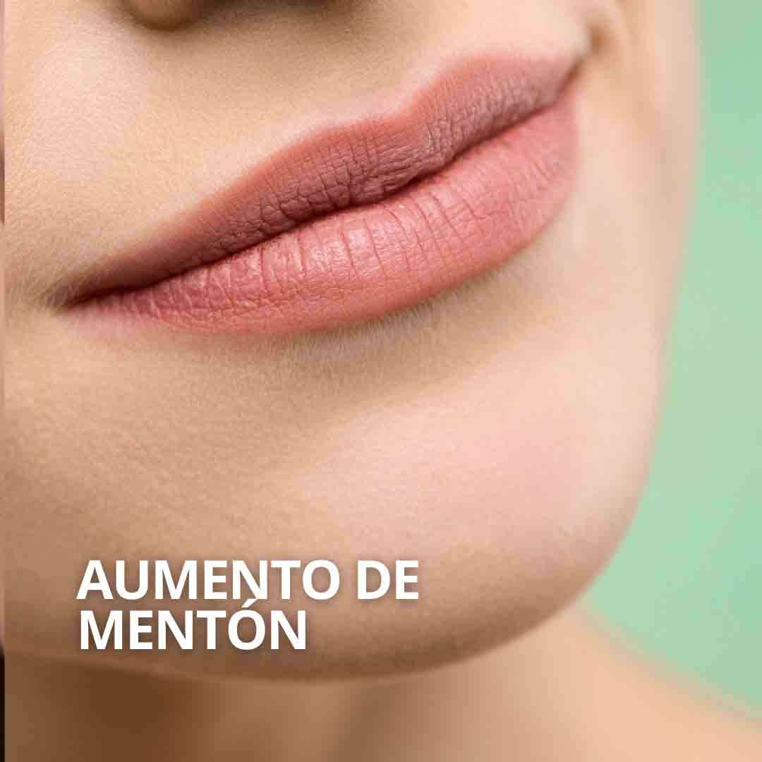 Aumento de mentón con ácido hialurónico Sevilla