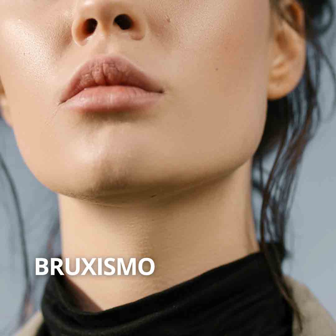 Neuromoduladores bruxismo Sevilla